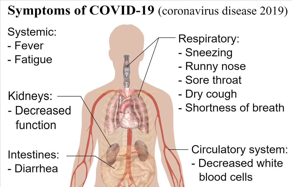 Symptômes du coronavirus (photo : Mikael Häggström, M.D., Wikimedia Commons).